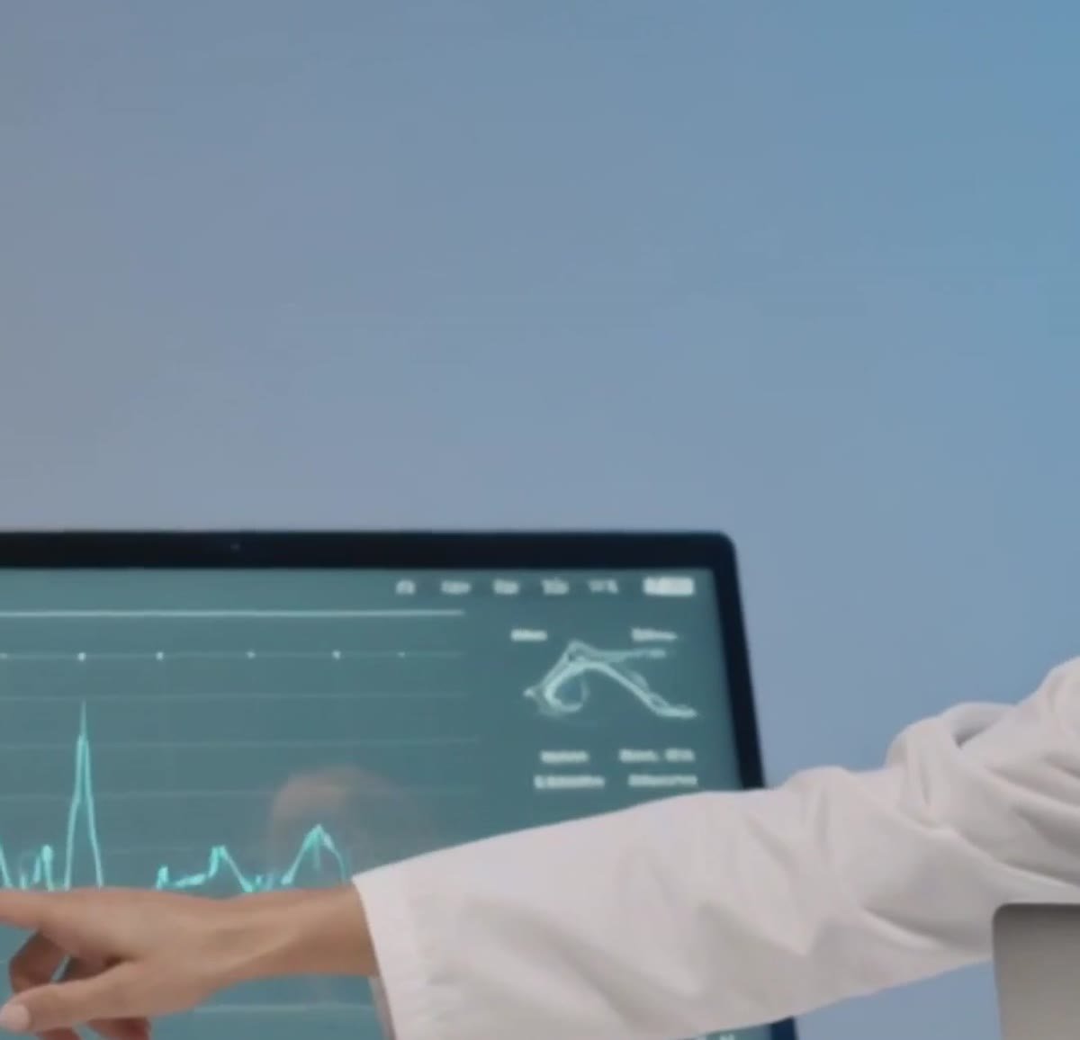 Doctor reviewing test results on a screen during a liver health check
