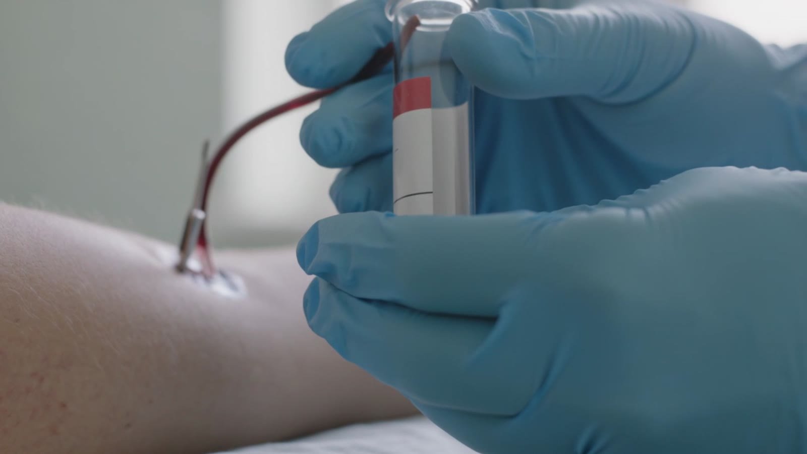 Enclomiphene vs. Testosterone Therapy: Raising T While Keeping Your Own Production